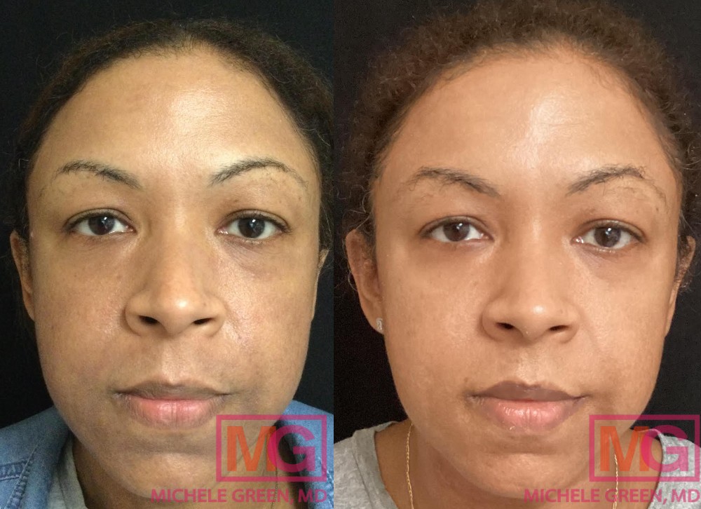 dermatologist before and after